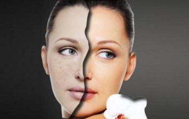 簡單的祛痘方法，讓你的皮膚時刻光滑細(xì)嫩